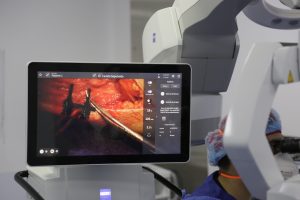 Imagen de Microcirugía